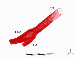 Blood Flow Analysis of a Bifurcating Artery Animation
